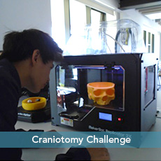 craniotomy challenge
